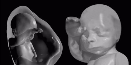 Virtual Reality May Help To Visualize Unborn Babies Better